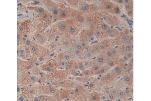 IHC-P analysis of liver tissue, with DAB staining. (ACADS Antikörper  (AA 210-396))