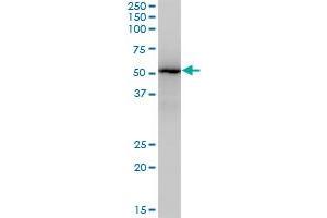 ZNF447 monoclonal antibody (M04), clone 2H1. (ZSCAN18 Antikörper  (AA 1-510))