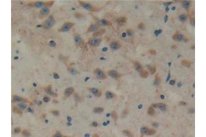 Detection of TXLNa in Mouse Cerebrum Tissue using Polyclonal Antibody to Taxilin Alpha (TXLNa)