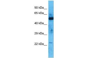Host:  Rabbit  Target Name:  ZNF772  Sample Type:  Thymus Tumor lysates  Antibody Dilution:  1. (ZNF772 Antikörper  (N-Term))