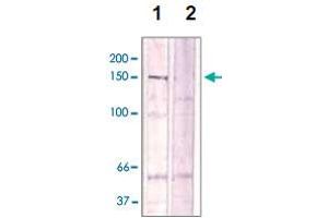 The cell lysate derived from Conditioned NIH/3T3 cell was immunoprecipitated by ROCK2 (phospho T396) polyclonal antibody , then immunoprobed by the same antibody at 1 : 500 (lane 1). (ROCK2 Antikörper  (pThr396))
