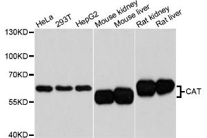 Western blot analysis of extracts of various cell lines, using CAT antibody. (Catalase Antikörper)