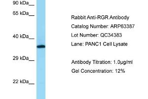 Western Blotting (WB) image for anti-Retinal G Protein Coupled Receptor (RGR) (N-Term) antibody (ABIN971567) (RGR Antikörper  (N-Term))