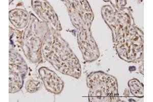Immunostaining (ISt) image for anti-ADAM Metallopeptidase with thrombospondin Type 1 Motif, 17 (ADAMTS17) (AA 543-650) antibody (ABIN566923)