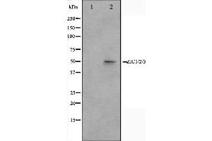 Western blot analysis on Jurkat cell lysate using ZIC1/2/3 Antibody,The lane on the left is treated with the antigen-specific peptide. (ZIC1/2/3 Antikörper)