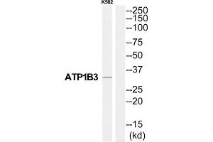 Western Blotting (WB) image for anti-ATPase, Na+/K+ Transporting, beta 3 Polypeptide (ATP1B3) (Internal Region) antibody (ABIN1852199) (ATP1B3 Antikörper  (Internal Region))