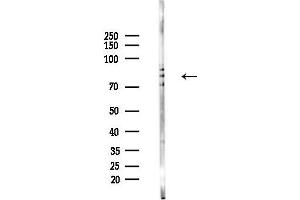 anti-DEAD (Asp-Glu-Ala-Asp) Box Polypeptide 17 (DDX17) (C-Term) antibody