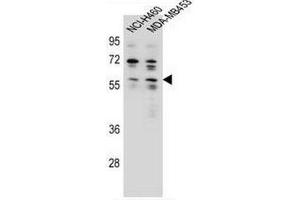ANKRD34C Antibody (C-term) western blot analysis in NCI-H460,MDA-MB453 cell line lysates (35µg/lane). (ANKRD34C Antikörper  (C-Term))