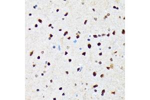 Immunohistochemistry of paraffin-embedded rat brain using CAMKIV Rabbit mAb (ABIN7266021) at dilution of 1:100 (40x lens). (CAMK4 Antikörper)