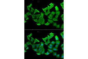 Immunofluorescence analysis of A549 cell using HAGH antibody. (HAGH Antikörper)