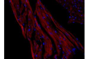 Immunohistochemistry (IHC) image for anti-Solute Carrier Family 2 (Facilitated Glucose Transporter), Member 4 (SLC2A4) (AA 495-509) antibody (ABIN1742482)