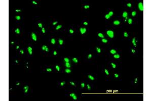 Immunofluorescence of monoclonal antibody to UBTF on HepG2 cell. (UBTF Antikörper  (AA 551-650))