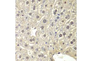 Immunohistochemistry of paraffin-embedded mouse liver using NR3C1 antibody at dilution of 1:200 (400x lens). (Glucocorticoid Receptor Antikörper)
