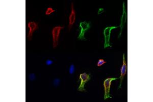 ABIN6258278 and ABIN6273860 staining Hela cells by IF/ICC. (GPR20 Antikörper  (C-Term))