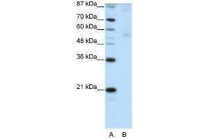 ZNF92 antibody (20R-1238) used at 0.