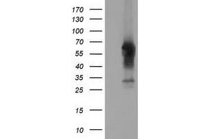 HEK293T cells were transfected with the pCMV6-ENTRY control (Left lane) or pCMV6-ENTRY CD5 (Right lane) cDNA for 48 hrs and lysed. (CD5 Antikörper)