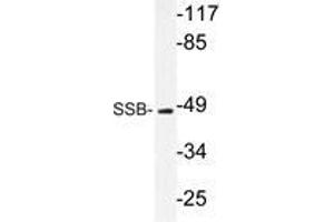 Western blot analysis of SSB antibody in extracts from 293 cells. (SSB Antikörper)