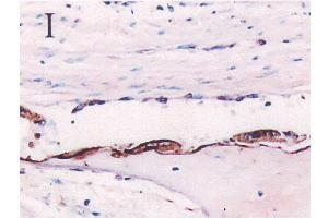 Immunohistochemistryimageof Osteopontin staining in paraffin section of fetal calvaria. (Osteopontin Antikörper  (AA 59-74))