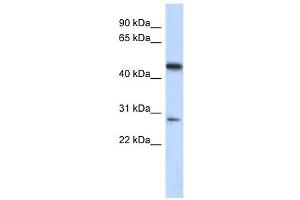 C13ORF31 antibody used at 1 ug/ml to detect target protein. (LACC1 Antikörper  (Middle Region))