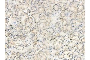 anti-CD2 (Cytoplasmic Tail) Binding Protein 2 (CD2BP2) (Internal Region) antibody