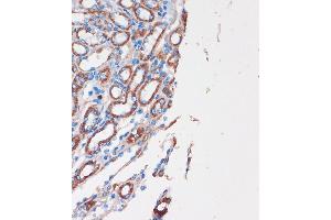 Immunohistochemistry of paraffin-embedded Mouse kidney using CHDH Rabbit pAb (ABIN7266341) at dilution of 1:100 (40x lens). (CHDH Antikörper  (AA 245-594))