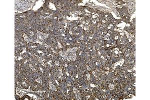 IHC analysis of Claudin 3/CLDN3 using anti-Claudin 3/CLDN3 antibody (ABIN7599626). (Claudin 3 Antikörper  (AA 101-220))