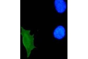 Immunofluorescence (IF) image for anti-Human Papilloma Virus 11 E7 (HPV-11 E7) (AA 36-70) antibody (ABIN781777) (Human Papilloma Virus 11 E7 (HPV-11 E7) (AA 36-70) Antikörper)