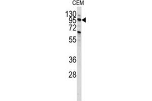 Western Blotting (WB) image for anti-Phosphoinositide-3-Kinase, Class 3 (PIK3C3) antibody (ABIN3000300)