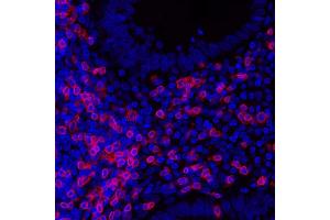 Immunofluorescence (IF) image for anti-CD3 epsilon (CD3E) (AA 157-207) antibody (ABIN7454035) (Rekombinanter CD3 epsilon Antikörper  (AA 157-207))