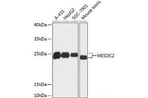 Western blot analysis of extracts of various cell lines using MESDC2 Polyclonal Antibody at dilution of 1:3000. (MESDC2 Antikörper)