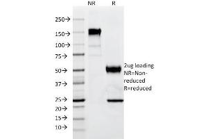 SDS-PAGE Analysis Purified p57 Mouse Monoclonal Antibody (SPM308). (CDKN1C Antikörper)