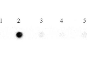 N6-Methyladenosine (m6A) antibody (pAb) tested by RNA dot blot analysis. (N6-Methyladenosine Antikörper)