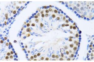 Immunohistochemistry of paraffin-embedded Mouse testis using DDX46 Polyclonal Antibody at dilution of 1:100 (40x lens). (DDX46 Antikörper)