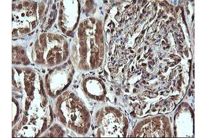 Image no. 5 for anti-Cell Division Cycle 123 Homolog (CDC123) antibody (ABIN1497388)