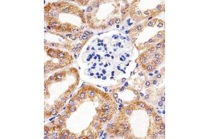 Immunohistochemical analysis of paraffin-embedded M. (BCL10 Antikörper  (AA 1-143))