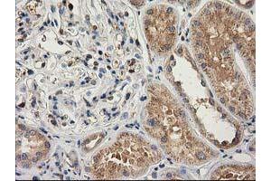 Immunohistochemical staining of paraffin-embedded Human Kidney tissue using anti-CAT mouse monoclonal antibody. (Catalase Antikörper)