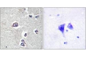 Immunohistochemistry analysis of paraffin-embedded human brain tissue, using PDGFR alpha (Ab-754) Antibody. (PDGFRA Antikörper  (AA 721-770))