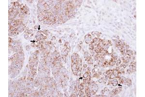 Immunohistochemistry (IHC) image for anti-Catenin (Cadherin-Associated Protein), alpha-Like 1 (CTNNAL1) (Internal Region) antibody (ABIN2856851)