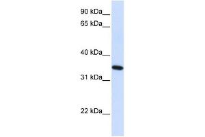 RTN1 antibody used at 1 ug/ml to detect target protein. (Reticulon 1 Antikörper  (N-Term))