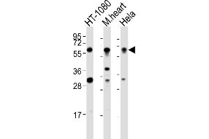 All lanes : Anti-SMYD2 Antibody (N-term) at 1:2000 dilution Lane 1: HT-1080 whole cell lysates Lane 2: mouse heart lysates Lane 3: Hela whole cell lysates Lysates/proteins at 20 μg per lane. (SMYD2A Antikörper  (N-Term))
