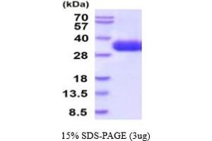 SDS-PAGE (SDS) image for Cytokine Receptor-Like Factor 2 (CRLF2) (AA 23-231) protein (His tag) (ABIN5854751) (CRLF2 Protein (AA 23-231) (His tag))