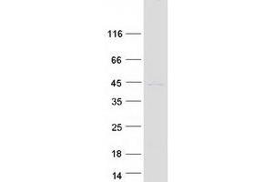 Western Blotting (WB) image for Fast Skeletal Troponin T (TNNT3) (Transcript Variant 1) protein (Myc-DYKDDDDK Tag) (ABIN2720887)