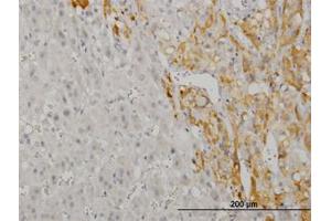 Image no. 1 for anti-CAMP Responsive Element Binding Protein 5 (CREB5) (AA 1-100) antibody (ABIN599087) (CREB5 Antikörper  (AA 1-100))