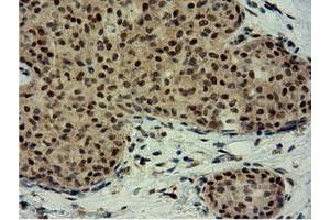 Image no. 7 for anti-EPM2A (Laforin) Interacting Protein 1 (EPM2AIP1) antibody (ABIN1498047) (EPM2AIP1 Antikörper)