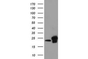 Western Blotting (WB) image for anti-Sjogren Syndrome/scleroderma Autoantigen 1 (SSSCA1) antibody (ABIN1501155)