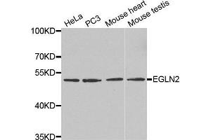 Western blot analysis of extracts of various cell lines, using EGLN2 antibody. (PHD1 Antikörper  (AA 150-250))