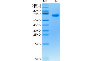 Human FCRL2 on Tris-Bis PAGE under reduced condition. (FCRL2 Protein (AA 20-401) (His tag))
