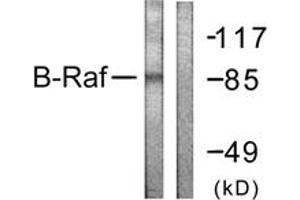 Western Blotting (WB) image for anti-B-Raf proto-oncogene, serine/threonine kinase (BRAF) (AA 576-625) antibody (ABIN2888763) (BRAF Antikörper  (AA 576-625))