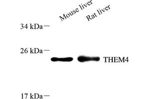 Western blot analysis of THEM4 (ABIN7075881),at dilution of 1: 600 (THEM4 Antikörper)