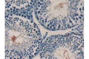 DAB staining on IHC-P; Samples: Mouse Testis Tissue (RANKL Antikörper  (AA 92-263))